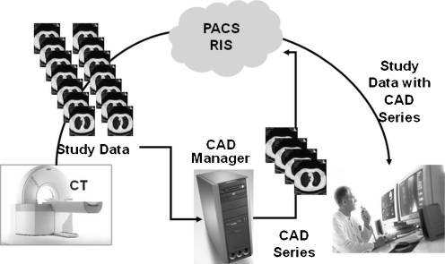 Computer Aided Diagnosis (CADe): Dataflow from modality to DICOM workstation