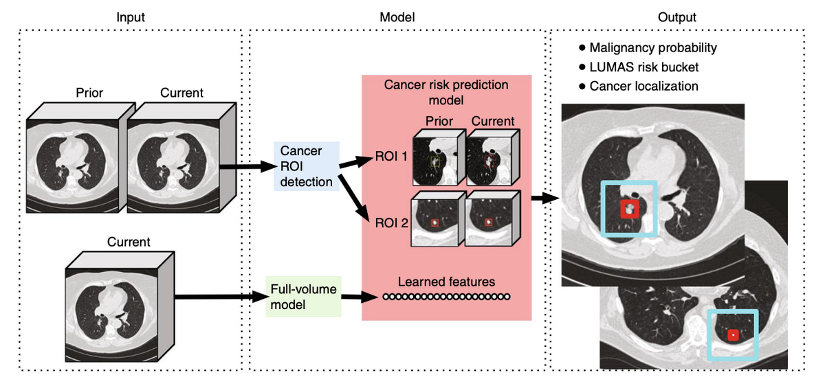 Northwestern AI: End to End Detection of Cancerous Lung Growths (Data Flow)