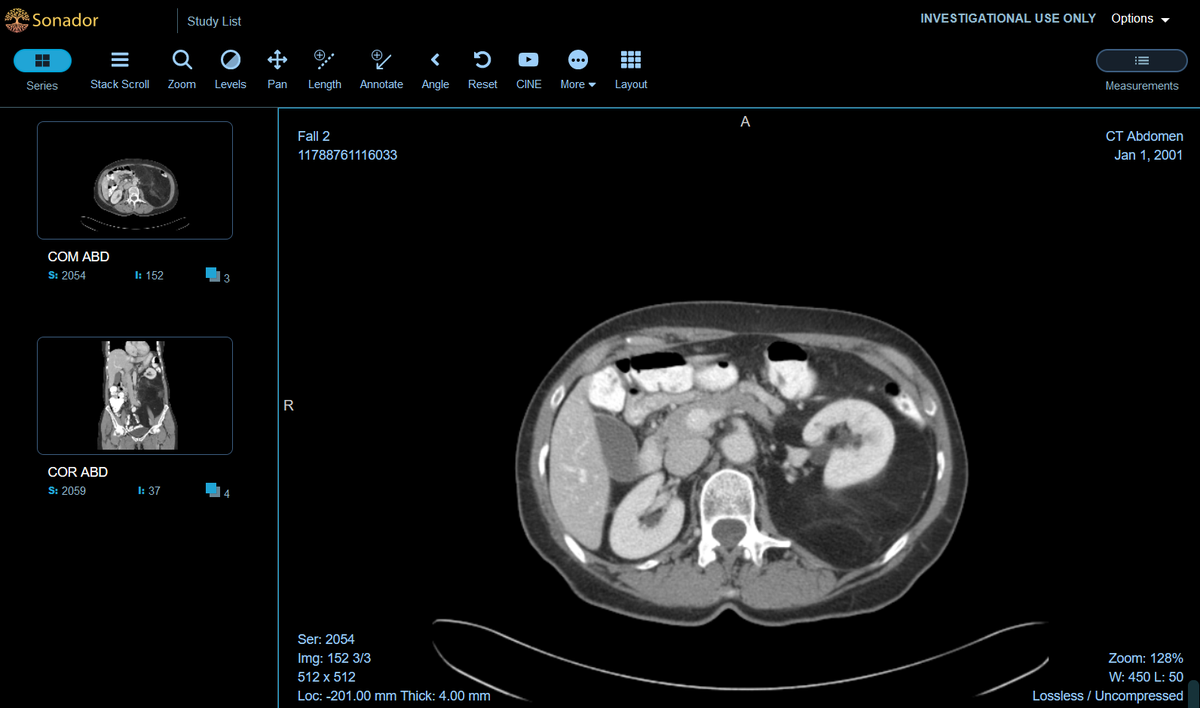 Sonador Interface: CT Scan