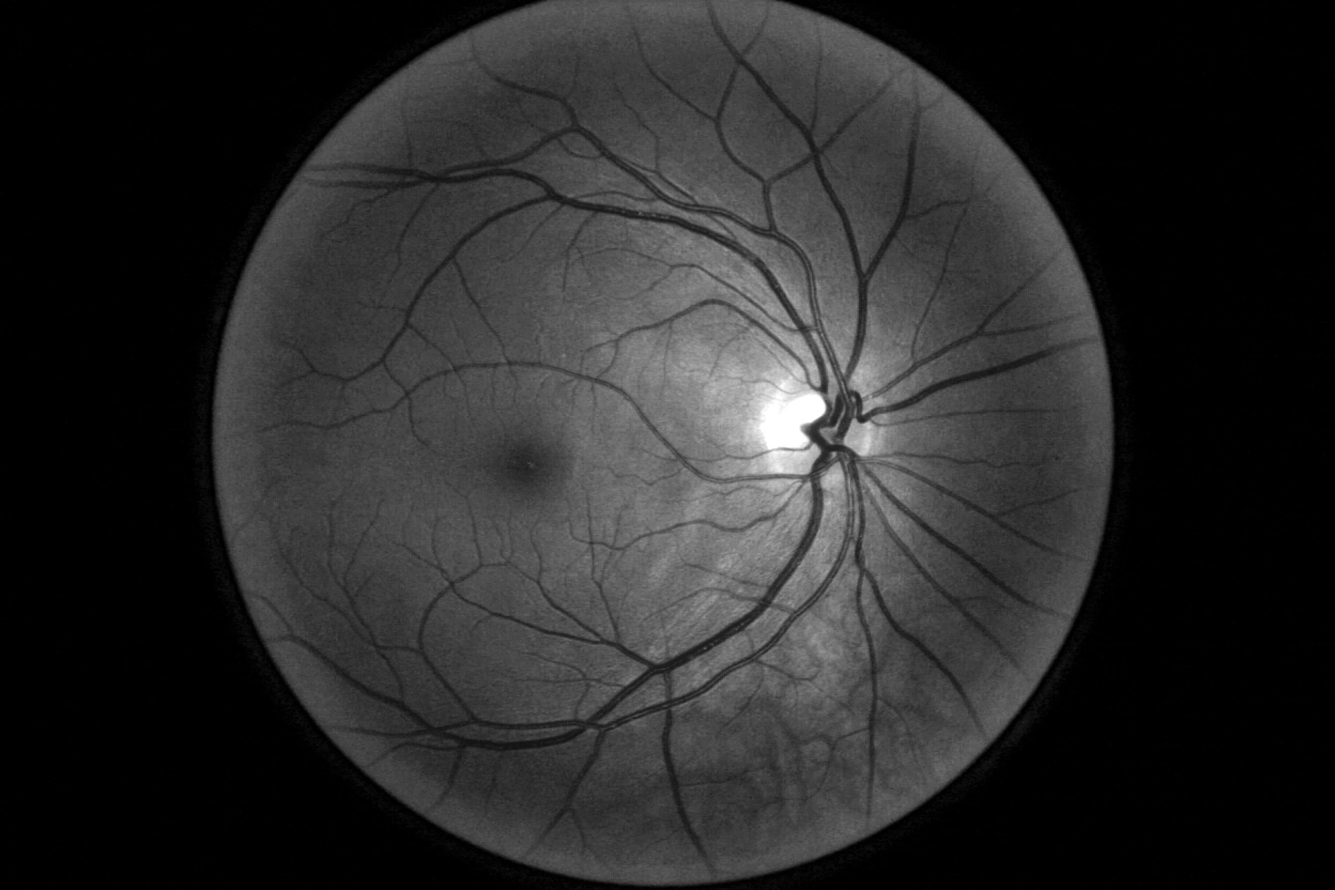 Retinal Scan