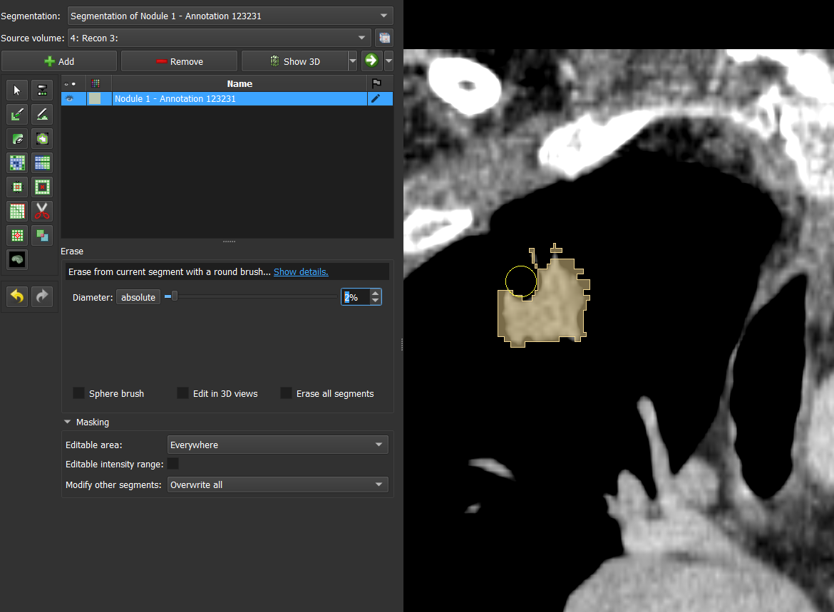 3D Slicer (5.7.0): Manual Segmentation / Pain Tool