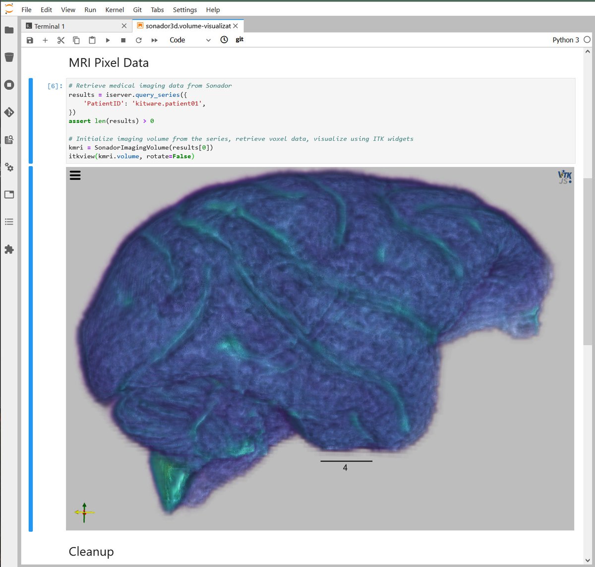 Sonador 3D: Brain Volume in JupyterLab