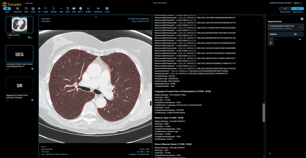Sonador UI (version 0.2): CT Scan and DICOM-SR document