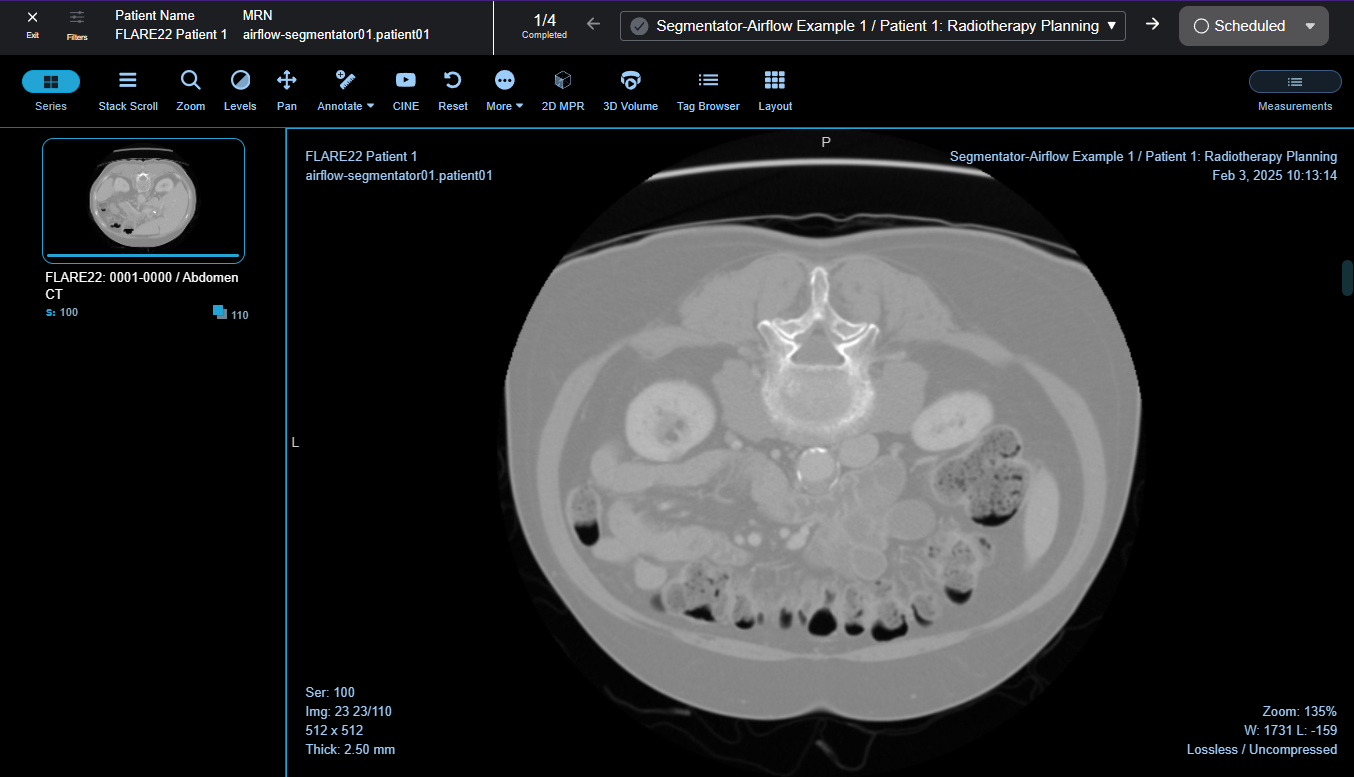 Sonador 0.4 Collaboration: Rapid Review Toolbar
