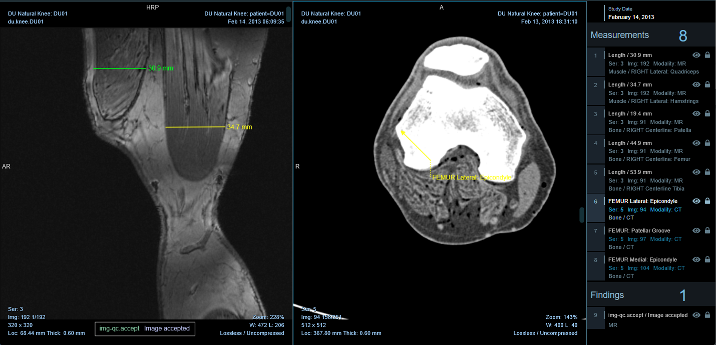 Sonador 0.4 Collaboration: Series tags render in the viewer and appear as findings