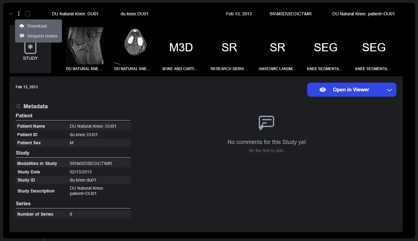 Sonador 0.4 Auth: Details drawer without a comment permission
