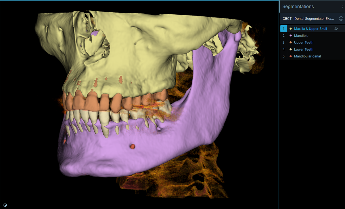 Sonador 0.4.1: Cornerstone3D Volume Rendering